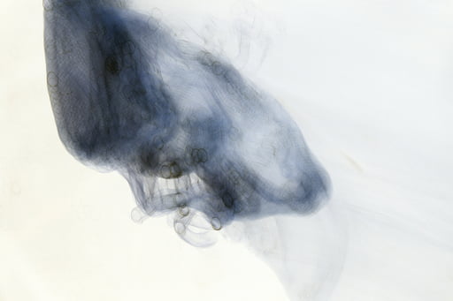 lungs negative